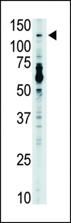 Invitrogen TLR7 Polyclonal Antibody 400 &mu;L; Unconjugated:Antibodies,