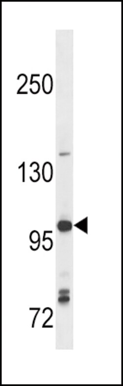 Invitrogen TLR7 Polyclonal Antibody 400 &mu;L; Unconjugated:Antibodies,