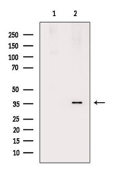 Invitrogen TIRAP Polyclonal Antibody 100 &mu;L; Unconjugated:Antibodies