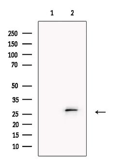 Invitrogen TMEM109 Polyclonal Antibody 100 μL; Unconjugated:Antibodies,