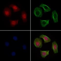 Invitrogen TMEM37 Polyclonal Antibody 100 &mu;L | Buy Online | Invitrogen&trade; | Fisher Scientific