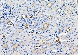 Invitrogen TMEM37 Polyclonal Antibody 100 &mu;L | Buy Online | Invitrogen&trade; | Fisher Scientific