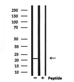 Invitrogen TMEM37 Polyclonal Antibody 100 &mu;L | Buy Online | Invitrogen&trade; | Fisher Scientific