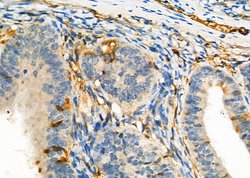 Invitrogen TMPRSS2 Polyclonal Antibody 100 &mu;L; Unconjugated:Antibodies,