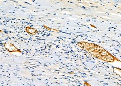 Invitrogen TMPRSS2 Polyclonal Antibody 100 &mu;L; Unconjugated:Antibodies,