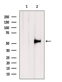 Invitrogen TMPRSS2 Polyclonal Antibody 100 &mu;L; Unconjugated:Antibodies,