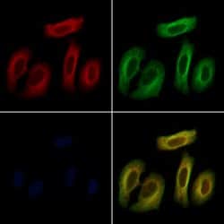 Invitrogen TNF beta Polyclonal Antibody 100 &mu;L; Unconjugated:Antibodies,