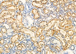 Invitrogen TNF beta Polyclonal Antibody 100 &mu;L; Unconjugated:Antibodies,