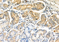 Invitrogen TNFRSF14 Polyclonal Antibody 100 μL; Unconjugated:Antibodies,
