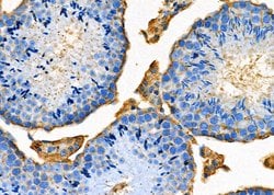 Invitrogen OX40L Polyclonal Antibody 100 &mu;L; Unconjugated:Antibodies,