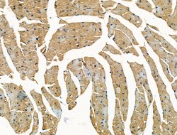 Invitrogen TOM1L2 Polyclonal Antibody 100 &mu;L; Unconjugated:Antibodies,