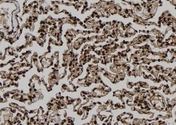 TP53I11 Polyclonal Antibody, Invitrogen&trade;