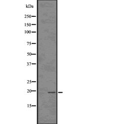 TP53I11 Polyclonal Antibody, Invitrogen™