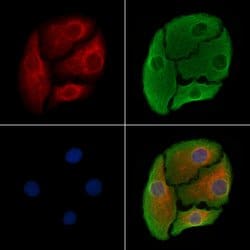 Invitrogen 5T4 Polyclonal Antibody 100 μL; Unconjugated:Antibodies,