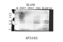 Invitrogen Transferrin Receptor Polyclonal Antibody 100 &mu;L; Unconjugated:Antibodies,