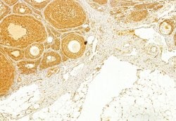 Invitrogen Transferrin Receptor Polyclonal Antibody 100 &mu;L; Unconjugated:Antibodies,