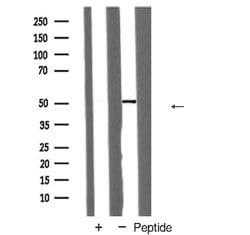 Invitrogen Transferrin Receptor Polyclonal Antibody 100 &mu;L; Unconjugated:Antibodies,