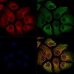 Invitrogen TREM2 Polyclonal Antibody 100 μL; Unconjugated:Antibodies,