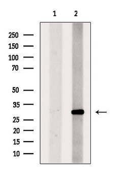 Invitrogen TREM2 Polyclonal Antibody 100 μL; Unconjugated:Antibodies,