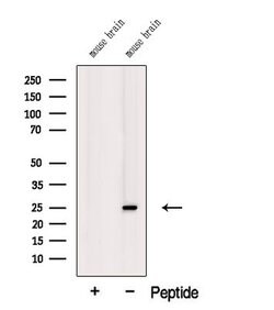 Invitrogen TREM2 Polyclonal Antibody 100 μL; Unconjugated:Antibodies,