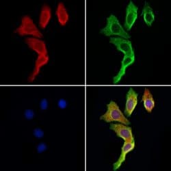 Invitrogen TRIM44 Polyclonal Antibody 100 &mu;L; Unconjugated:Antibodies,