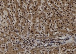 Invitrogen TRIM44 Polyclonal Antibody 100 &mu;L; Unconjugated:Antibodies,