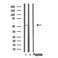 Invitrogen TRIM44 Polyclonal Antibody 100 &mu;L; Unconjugated:Antibodies,