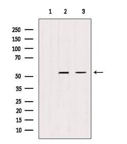 Invitrogen TRIM44 Polyclonal Antibody 100 &mu;L; Unconjugated:Antibodies,