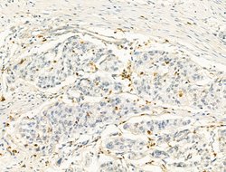 Invitrogen ZFP36 Polyclonal Antibody 100 μL; Unconjugated:Antibodies,