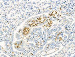 Invitrogen ZFP36 Polyclonal Antibody 100 μL; Unconjugated:Antibodies,