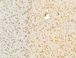 Invitrogen ZFP36 Polyclonal Antibody 100 μL; Unconjugated:Antibodies,