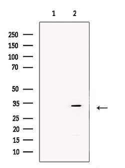 Invitrogen ZFP36 Polyclonal Antibody 100 μL; Unconjugated:Antibodies,