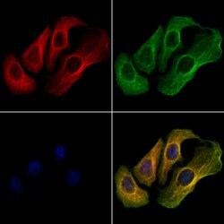 Invitrogen TRPC3 Polyclonal Antibody 100 &mu;L; Unconjugated:Antibodies,