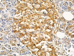Invitrogen TRPC3 Polyclonal Antibody 100 &mu;L; Unconjugated:Antibodies,