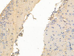 Invitrogen TRPC3 Polyclonal Antibody 100 &mu;L; Unconjugated:Antibodies,