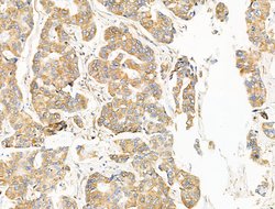 Invitrogen TRPC3 Polyclonal Antibody 100 &mu;L; Unconjugated:Antibodies,