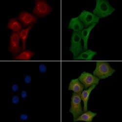 Invitrogen TRPC4 Polyclonal Antibody 100 &mu;L; Unconjugated:Antibodies,