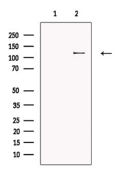Invitrogen TRPC4 Polyclonal Antibody 100 &mu;L; Unconjugated:Antibodies,
