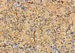 Invitrogen TSC22D1 Polyclonal Antibody 100 &mu;L | Buy Online | Invitrogen&trade; | Fisher Scientific