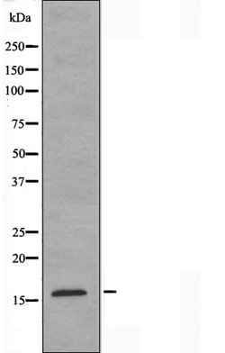 Invitrogen TSC22D1 Polyclonal Antibody 100 &mu;L | Buy Online | Invitrogen&trade; | Fisher Scientific