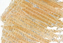 TSG101 Polyclonal Antibody:Antibodies, Polyclonal