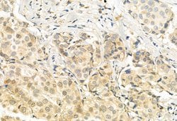 TSG101 Polyclonal Antibody:Antibodies, Polyclonal