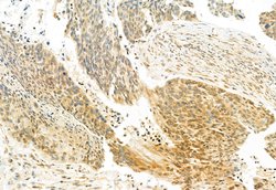 TSG101 Polyclonal Antibody:Antibodies, Polyclonal