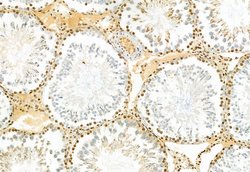 TSG101 Polyclonal Antibody:Antibodies, Polyclonal