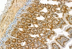 TSG101 Polyclonal Antibody:Antibodies, Polyclonal