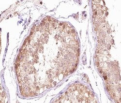 gamma Tubulin Polyclonal Antibody, Invitrogen 100 &mu;L; Unconjugated:Antibodies,