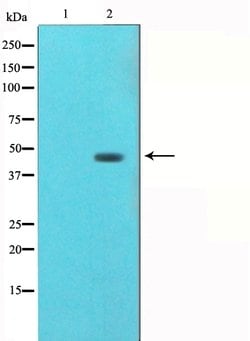 gamma Tubulin Polyclonal Antibody, Invitrogen 100 &mu;L; Unconjugated:Antibodies,