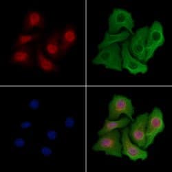 Invitrogen TUT1 Polyclonal Antibody 100 &mu;L; Unconjugated:Antibodies,