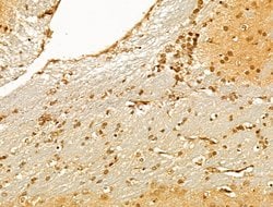 Invitrogen TUT1 Polyclonal Antibody 100 &mu;L; Unconjugated:Antibodies,