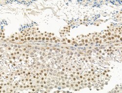Invitrogen TUT1 Polyclonal Antibody 100 &mu;L; Unconjugated:Antibodies,